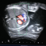 Ecocardiograma Fetal ($ARS)