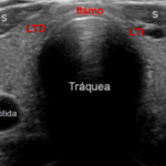 Ecografía de Órganos de Cuello ($ARS)