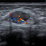 Ecografía Mamaria ($ARS)