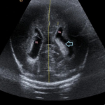 Ecografía Pediátrica($ARS)