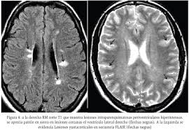 Curso de TC y RMN de Sistema Nervioso Central
