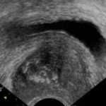 Ecografía Renal. Eco-Doppler Escrotal, Prostático y Vesical ($ARS)
